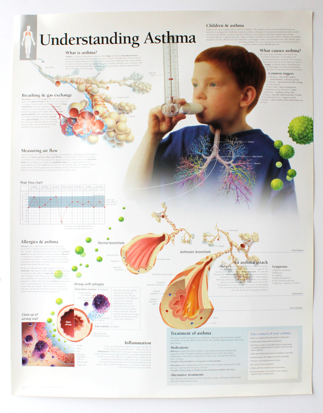 Understanding Asthma Chart